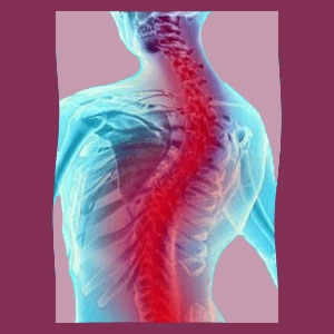 Scoliosis Back Pain